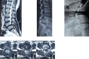 Lumbar Spinal Treatment