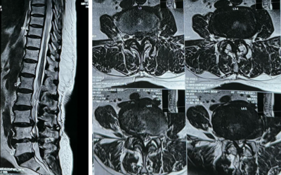 Best doctor for lumbar spine pain