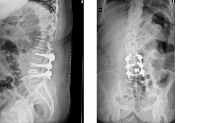 Best doctor for lumbar spine pain