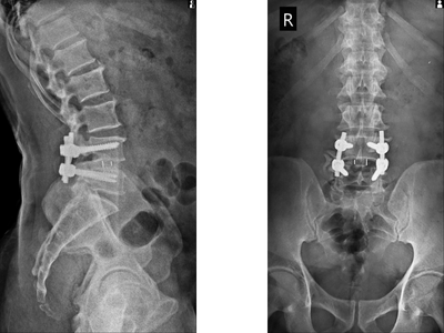 Back Pain Relief