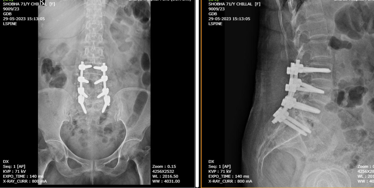 Chronic back and knee pain treatment